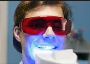 denti bianchi dal dentista